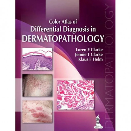 COLOR ATLAS OF DIFFERENTIAL DIAGNOSIS IN DERMATOPATHOLOGY book by Clarke Loren E