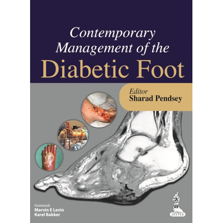 Contemporary Management of the Diabetic Foot book by Pendsey Sharad