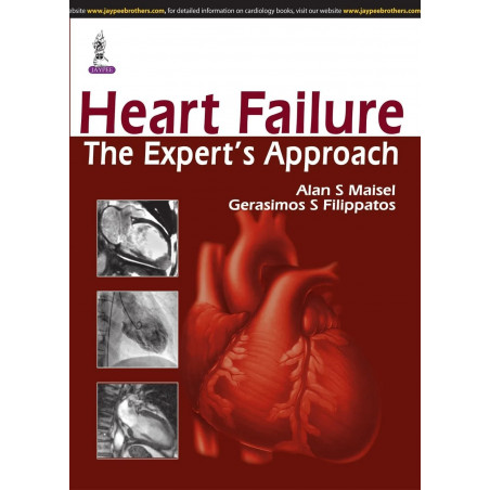 HEART FAILURE THE EXPERT'S APPROACH book by Maisel Alan S