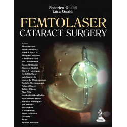 FEMTOLASER CATARACT SURGERY book by Gualdi Federica