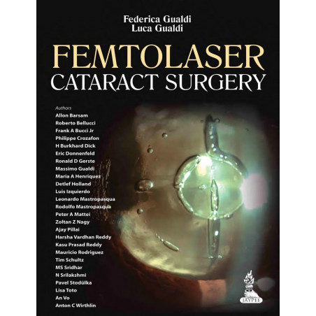 FEMTOLASER CATARACT SURGERY book by Gualdi Federica