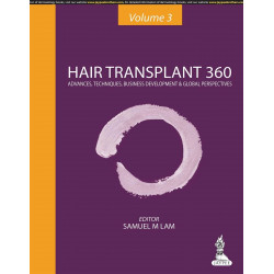 Hair Transplant 360: Advances, Techniques, Business Development, and Global Perspectives (Volume-3) book by Lam Samuel M