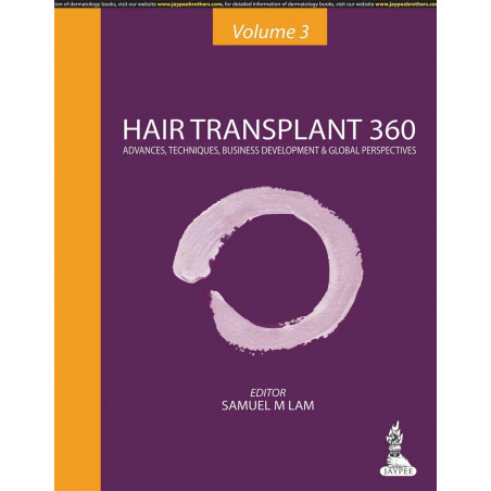 Hair Transplant 360: Advances, Techniques, Business Development, and Global Perspectives (Volume-3) book by Lam Samuel M