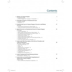 FEMTOLASER CATARACT SURGERY book by Gualdi Federica - Additional Image 5