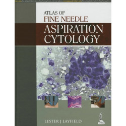 Atlas of Fine Needle Aspiration Cytology book by Layfield Lester J