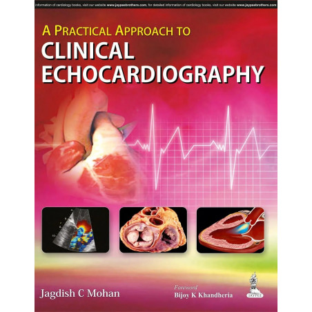 A PRACTICAL APPROACH TO CLINICAL ECHOCARDIOGRAPHY book by Mohan Jagdish C