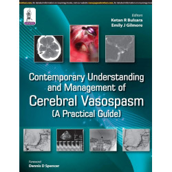 Contemporary Understanding and Management of Cerebral Vasospasm: A Practical Guide book by Bulsara Ketan R
