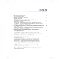 Contemporary Understanding and Management of Cerebral Vasospasm: A Practical Guide book by Bulsara Ketan R - Additional Image 6