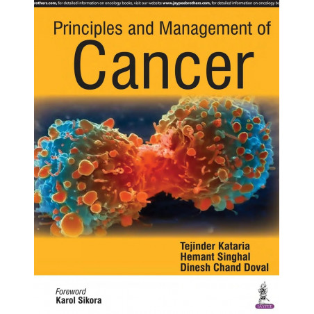 PRINCIPLES AND MANAGEMENT OF CANCER book by Kataria Tejinder