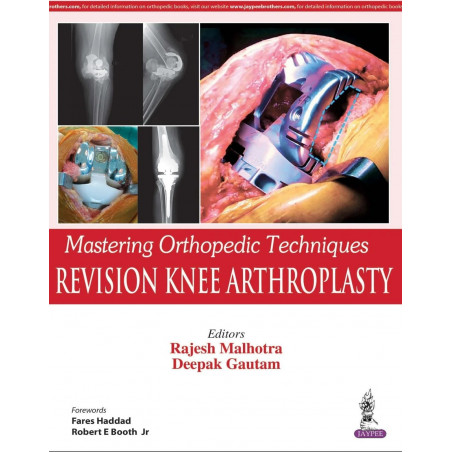 Mastering Orthopedic Techniques Revision Knee Arthroplasty book by Rajesh Malhotra & Deepak Gautam