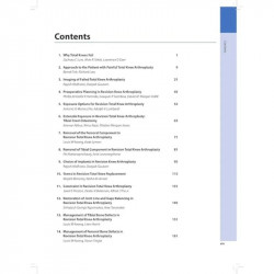 Mastering Orthopedic Techniques Revision Knee Arthroplasty book by Rajesh Malhotra & Deepak Gautam - Additional Image 6