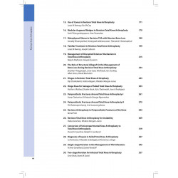 Mastering Orthopedic Techniques Revision Knee Arthroplasty book by Rajesh Malhotra & Deepak Gautam - Additional Image 7
