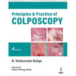 Principles & Practice of Colposcopy book by B. Shakuntala Baliga
