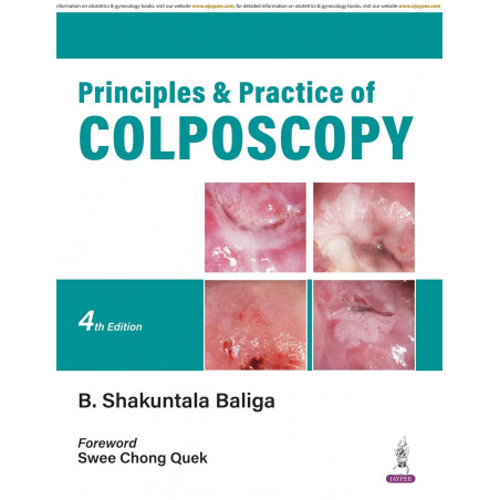 Principles & Practice of Colposcopy book by B. Shakuntala Baliga