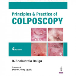 Principles & Practice of Colposcopy book by B. Shakuntala Baliga - Back Cover