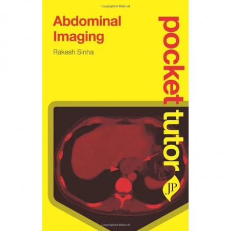 ABDOMINAL IMAGING: POCKET TUTOR book