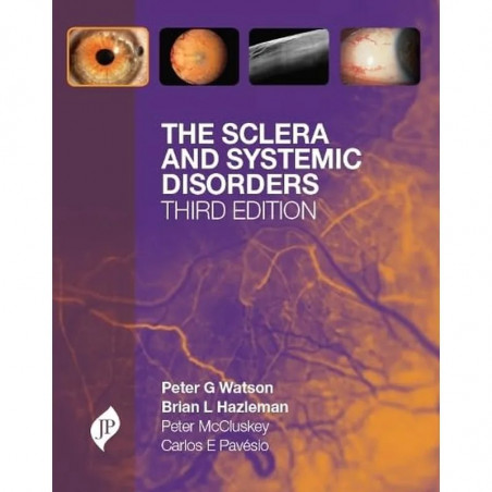 The Sclera and Systemic Disorders book by Watson