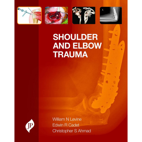 Shoulder and Elbow Trauma book by Levine
