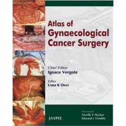 ATLAS OF GYNAECOLOGICAL CANCER SURGERY book