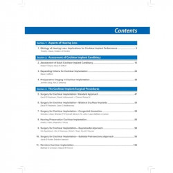 COCHLEAR IMPLANTS: FROM PRINCIPLES TO PRACTICE book by David S Haynes - Additional Image 6