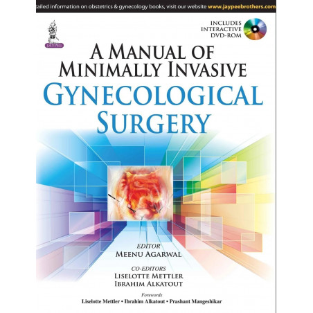 A MANUAL OF MINIMALLY INVASIVE GYNECOLOGICAL SURGERY book by Agarwal