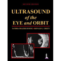 Ultrasound of the Eye & Orbit book by Byrne