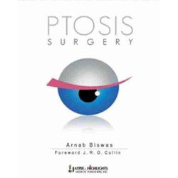 PTOSIS SURGERY book by Biswas Arnab