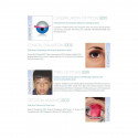 PTOSIS SURGERY book by Biswas Arnab - Additional Image 6