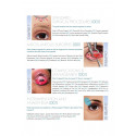 PTOSIS SURGERY book by Biswas Arnab - Additional Image 7