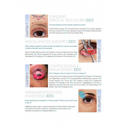 PTOSIS SURGERY book by Biswas Arnab - Additional Image 7