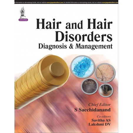 HAIR AND HAIR DISORDERS: DIAGNOSIS & MANAGEMENT book by Sacchidanand S
