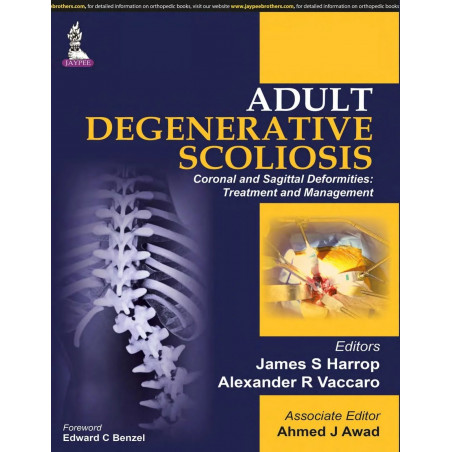 Adult Degenerative Scoliosis—Coronal and Sagittal Deformities: Treatment and Management book by Harrop James S