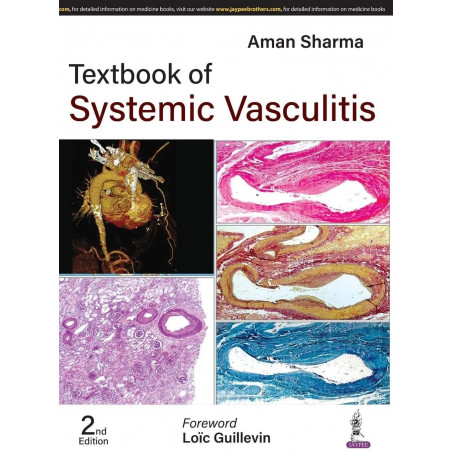 TEXTBOOK OF SYSTEMIC VASCULITIS book by Aman Sharma