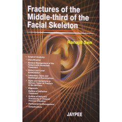 Fractures Of The Middle-Third Of The Facial Skeleton book by Sen