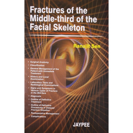 Fractures Of The Middle-Third Of The Facial Skeleton book by Sen