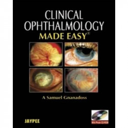OPHTHALMOLOGY MADE EASY WITH PHOTO CD-ROM book by Gnanadoss A Samuel