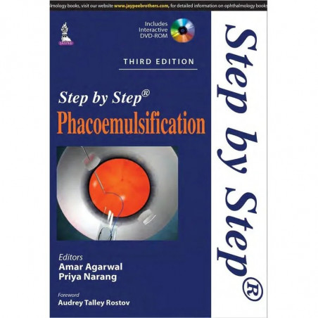 Step by Step Phacoemulsification with DVD-ROM book by Agarwal Amar