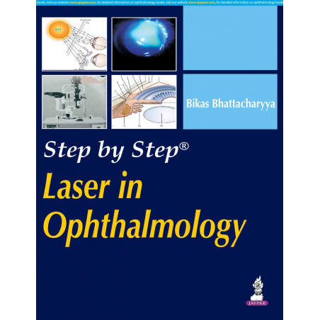 Step by Step Laser in Ophthalmology (with Photo CD Rom) book by Bikas Bhattacharya