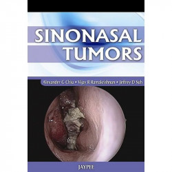 SINONASAL TUMORS book by Alexander Chiu
