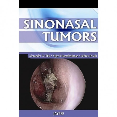 SINONASAL TUMORS book by Alexander Chiu