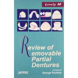 Review Of Removable Partial Dentures book by Lovely