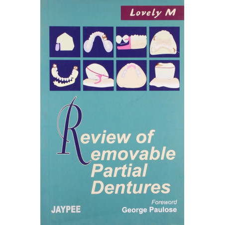 Review Of Removable Partial Dentures book by Lovely