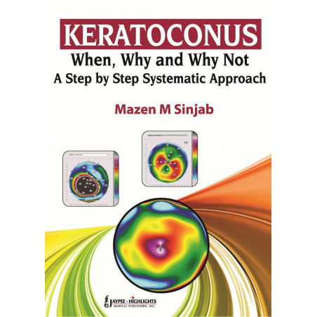 Keratoconus: When, Why and Why Not A Step by Step Systematic Approach (POD) book by Sinjab