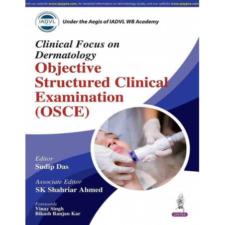 CLINICAL FOCUS ON DERMATOLOGY OBJECTIVE STRUCTURED CLINICAL EXAMINATION (OSCE) book by Sudip Das, SK Shahriar Ahmed