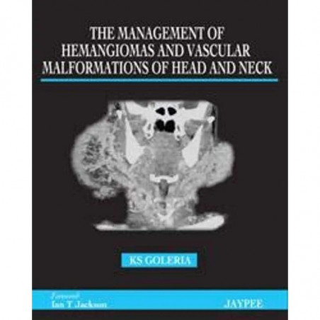 The Management of Hemangiomas and Vascular Malformations of Head and Neck book by Goleria