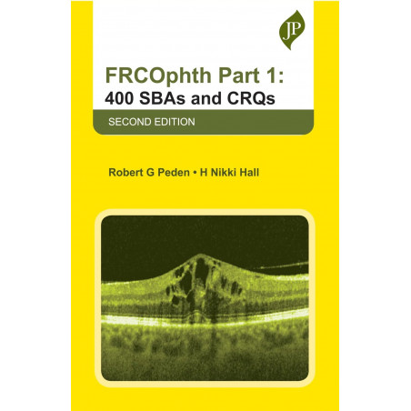 FRCOPHTH PART 1: 400 SBAS AND CRQS book by H Nikki Hall, Robert G Peden