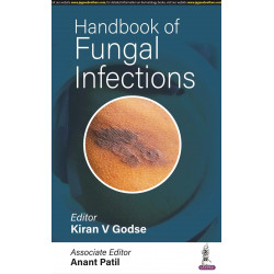 HANDBOOK OF FUNGAL INFECTIONS book by Kiran V Godse