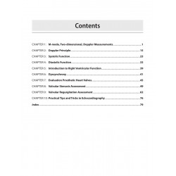 Echocardiography Simplified: A Practical Approach for Cardiology Postgraduates (DM/DNB) & Cardiac Sonographers | Step-by-Ste… -