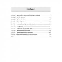Echocardiography Simplified: A Practical Approach for Cardiology Postgraduates (DM/DNB) & Cardiac Sonographers | Step-by-Ste… -