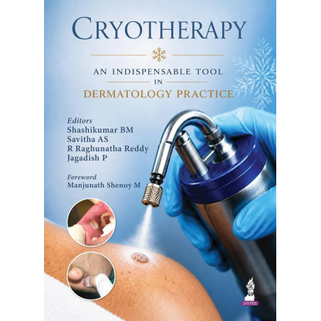 Cryotherapy: An Indispensable Tool in Dermatology Practice for Dermatology Postgraduates and Practicing Dermatologists | Cry…